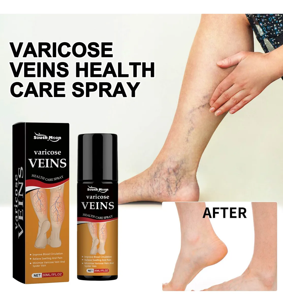 Turmeric Varicose Veins Relief Spray - (BUY 1 GET 1 FREE🔥🔥)